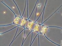 Vue microscopique d'une diatomee Chaetoceros